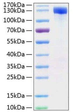 Novus Biologicals Recombinant Mouse ErbB2/Her2 Fc His (C-Term) Protein 100 &mu;g | Buy Online | Novus Biologicals&trade; | Fisher Scientific